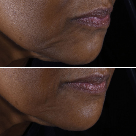 CLINIQUE-Smart Clinical Repair - Crème Liftante Visage + Cou CLINIQUE-Smart Clinical Repair - Crème Liftante Visage + Cou